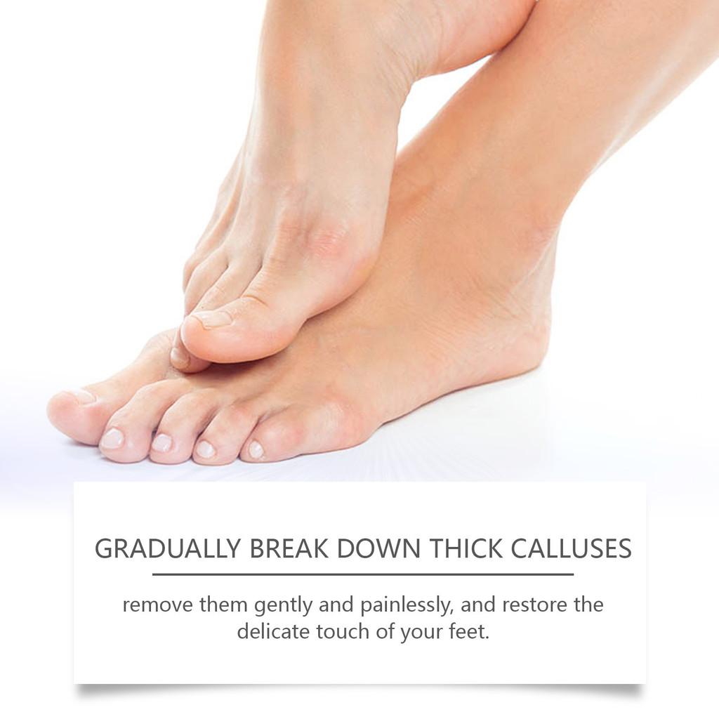 Ouhoe Foot Peel Repair Cream Gentle Moisturizing Softening For Dry And Cracked Skin