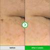 CHUNGMIJUNG - Kakadu-Pflaume Melasma Fleckencreme