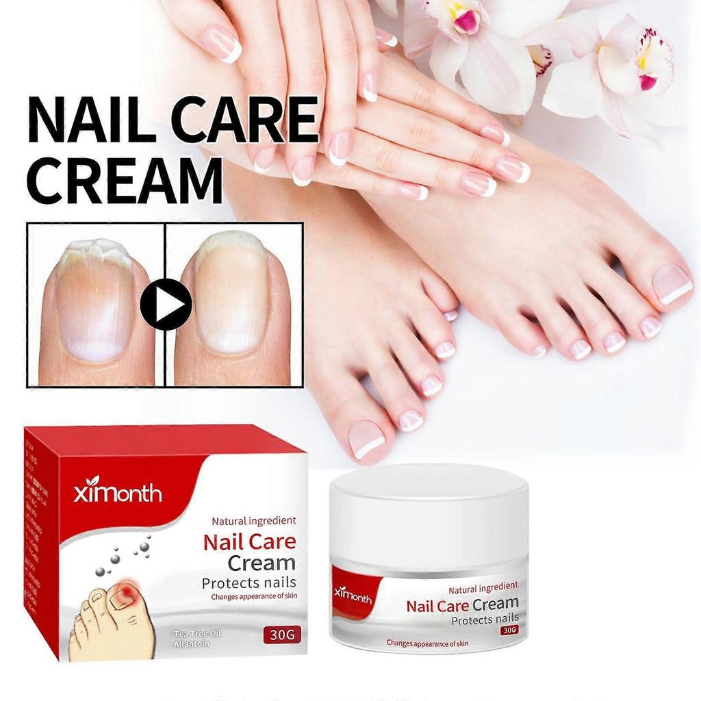 Ximonth Nail Repair Cream For Gray Nails  Repairs And Brightens Nails, Treats Ingrown And Rotting Toenails, Thickened Nails, And Nail Groove Care
