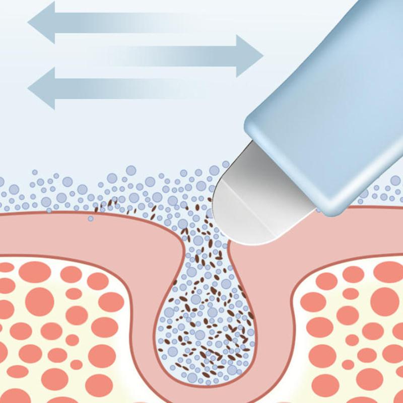 Deep Cleansing Blackhead And Whitehead Removal Tool For Nose And Face Skin Pore Cleaner Face Scraper Skin Care Beauty Tools