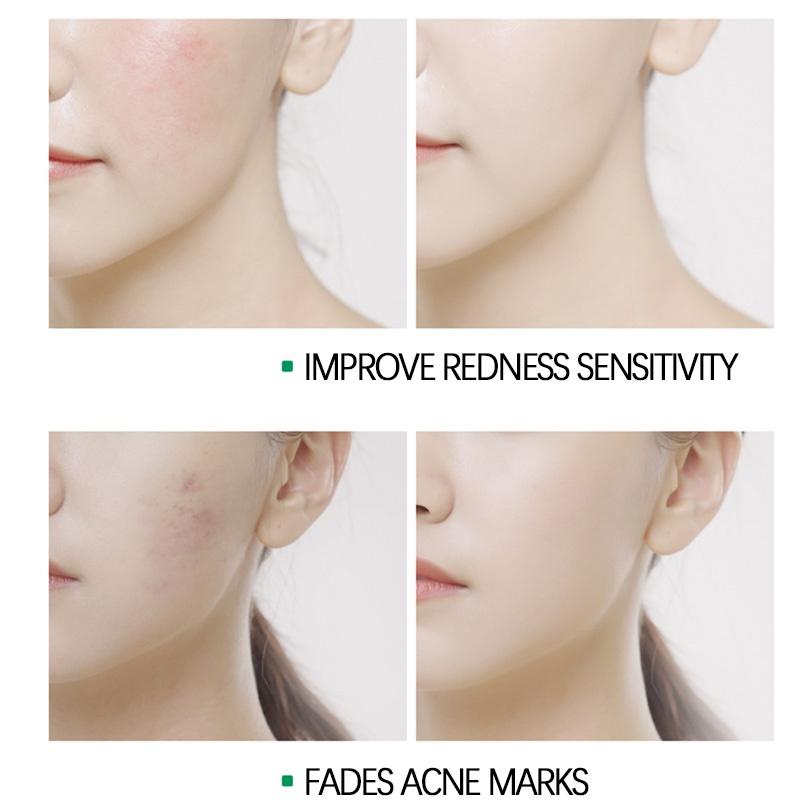 Aloe Vera krém na obličej, hydratační, opravující, rozjasňující péče o pleť obličeje