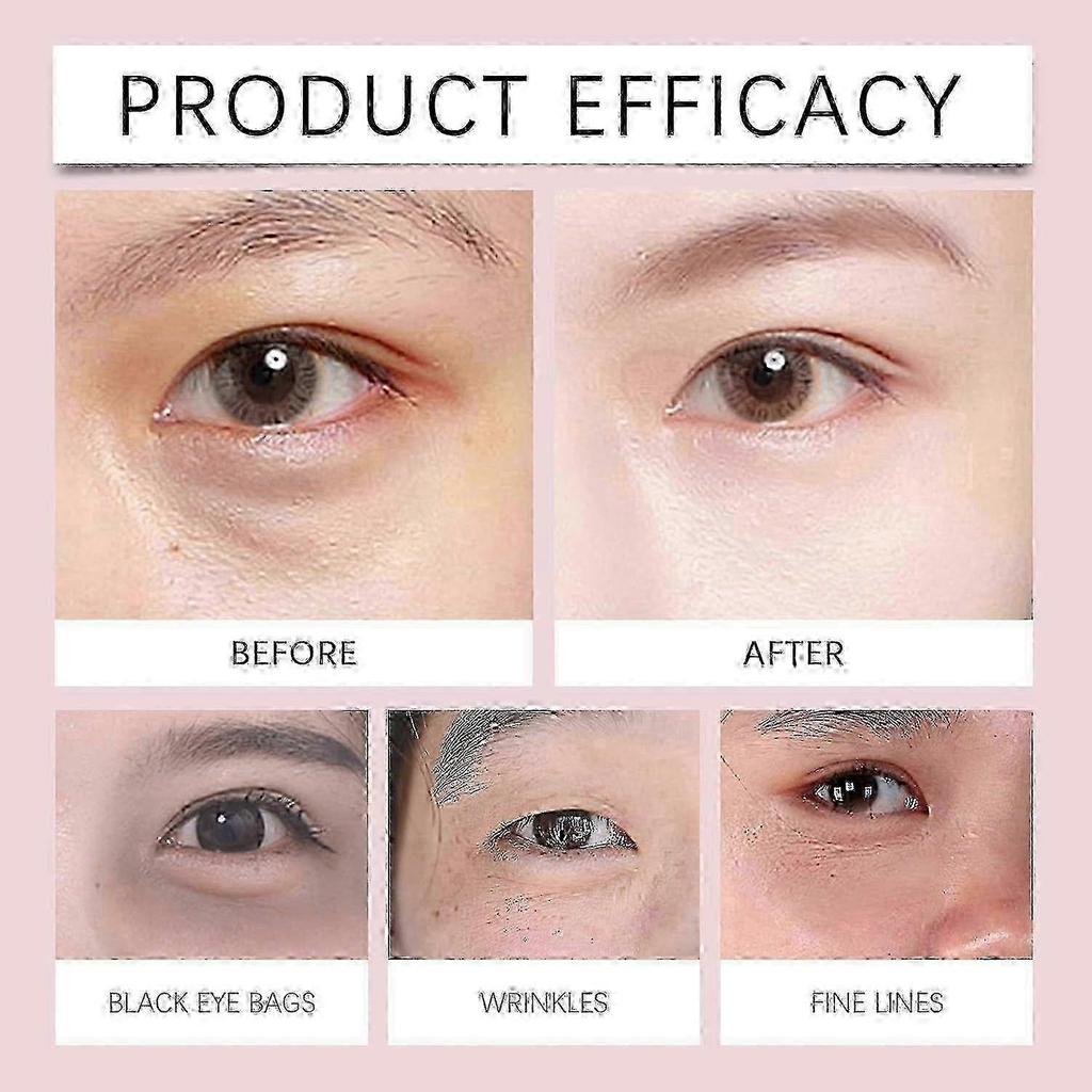 AH-8 Firming Neck Cream + Electric Massage Eye Cream, Neck-Eye Care Tightening & Revitalizing Set, Eye & Neck Treatment, Smooth of Fine Lines 25-26