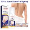 Jaysuing Back Care Spray For Fading Acne Marks And Smoothing Skin Texture