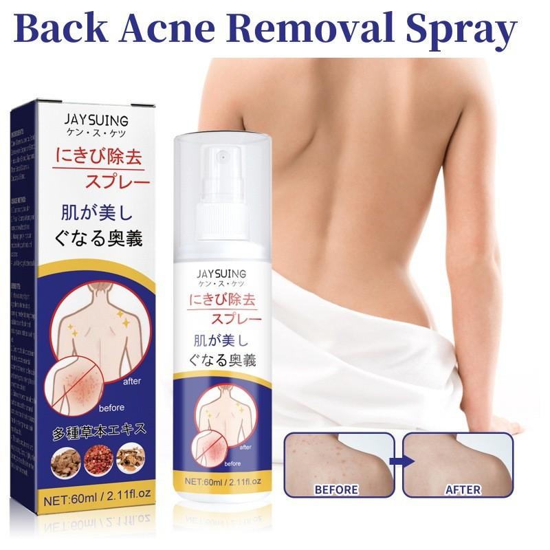 Jaysuing Back Care Spray For Fading Acne Marks And Smoothing Skin Texture