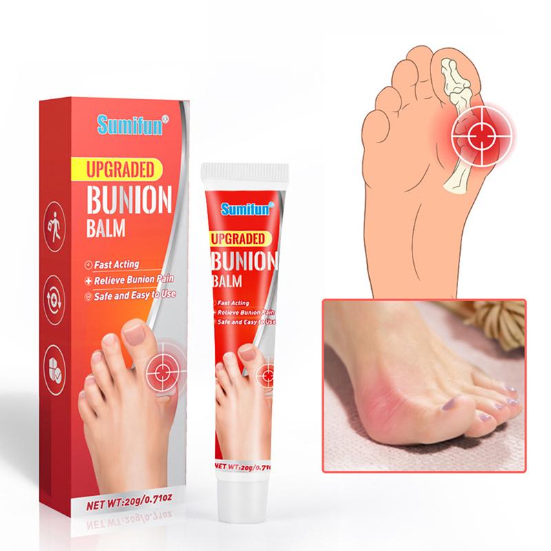 20G Bunion Gout Pain Relief Ointment Toe Joint Valgus Corrector Cream Hallux Knee Lumbar Arthritis Treatment Care Cream