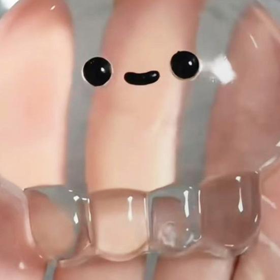 Transparente Cartoon Qualle Squeeze Spielzeug Stress Angst Abbau Glitzer Qualle Sensorisches Spielzeug Kinder Jugendliche Erwachsene Tragbar Weiche TPR Qualle Knetspielzeug