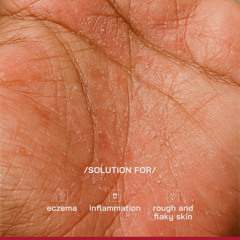 PHD 1% Ceramides Intensive Repair Cream 30ml X Pack of 2 for Dry, Sensitive & Eczema-Prone Skin