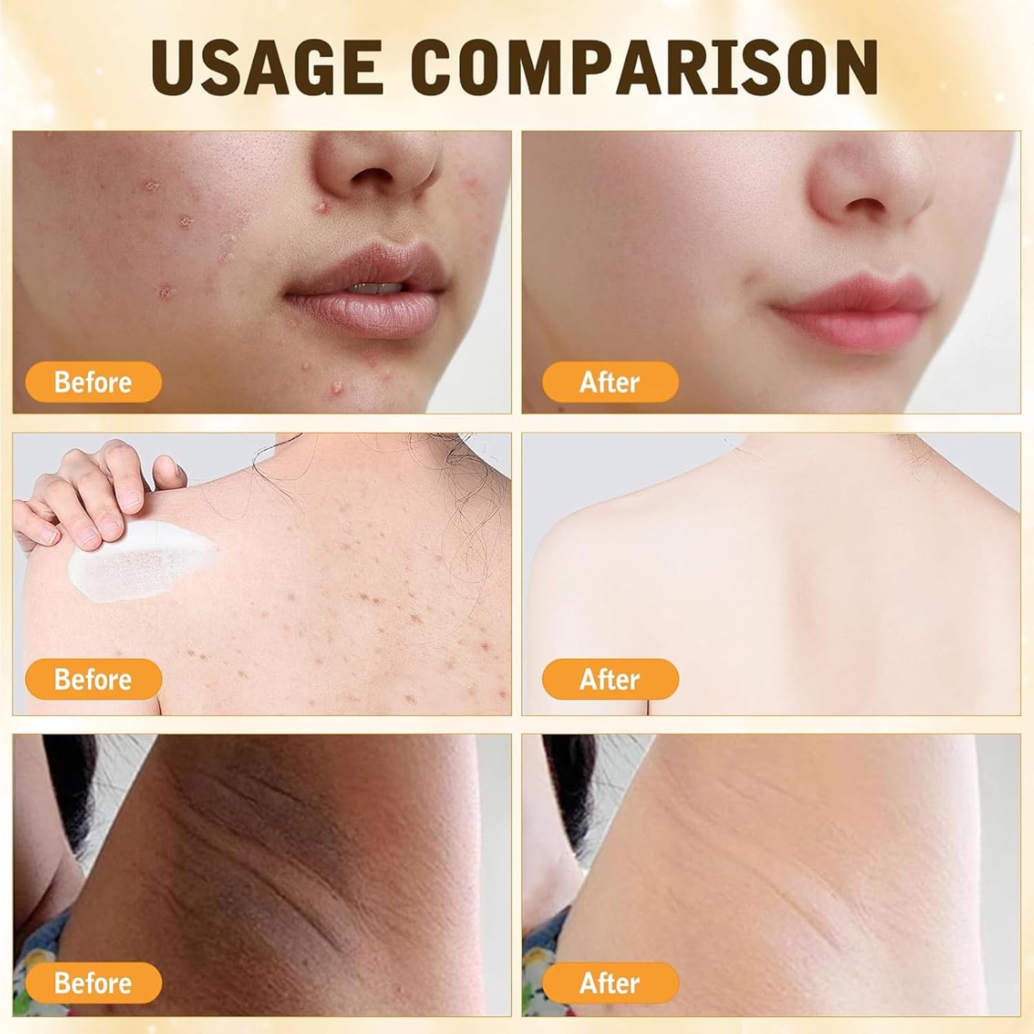 Bee Venom Comprehensive Cream, 2025 New Skincare Treatment Bee Venom Skin Cream, Visibly reduces skin blemishes, Natural Skin Moisturizer for Face