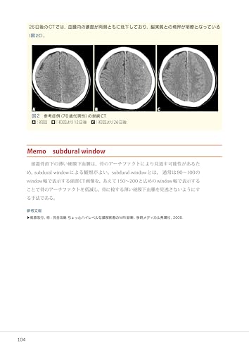Mastering Head CT and MRI Imaging and Interpretation