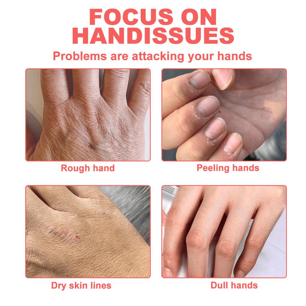 20Pcs/Box Peach Hand Cream,Delicate And Nourishing Hand Skin,Smoothing Hands,Improve Dry Crack,Repai