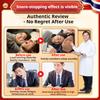Anti-snoring Sticker for Snoring Men and Women