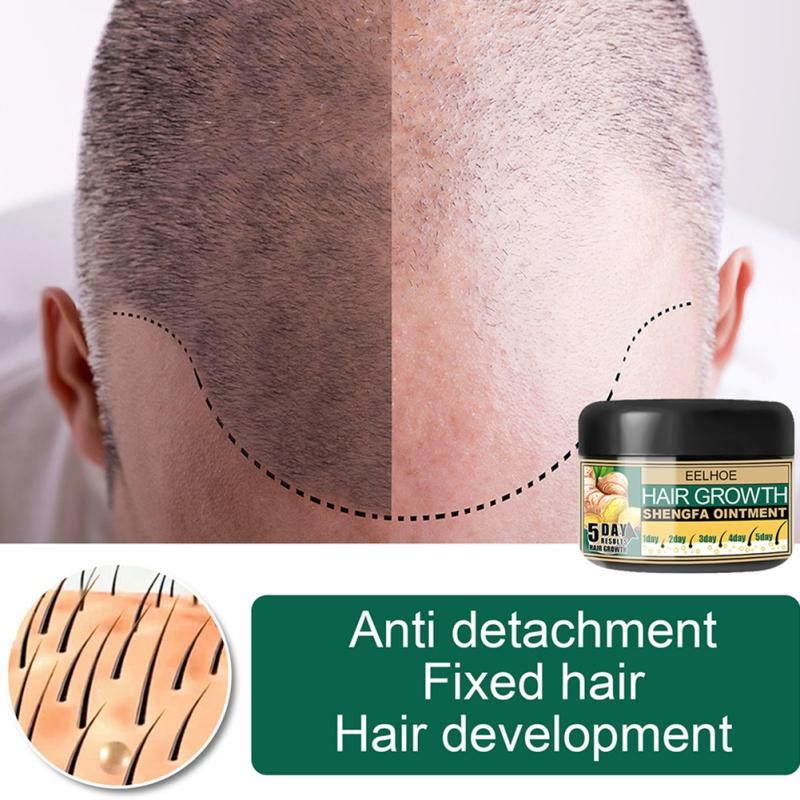 30g Hair Growth Ointment Strengthen Hair Roots Nourish Hair Prevent Hair Loss