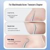 Blackhead & Acne Removal Set: Disposable Pimple Needle & Ultra-Fine Tweezers