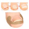 40pc Toe Nail Correction Patches Self-Adhesive Ingrown Toenail Correct Strip Nail Cover Sticker Nail Straightener Pedicure Tool