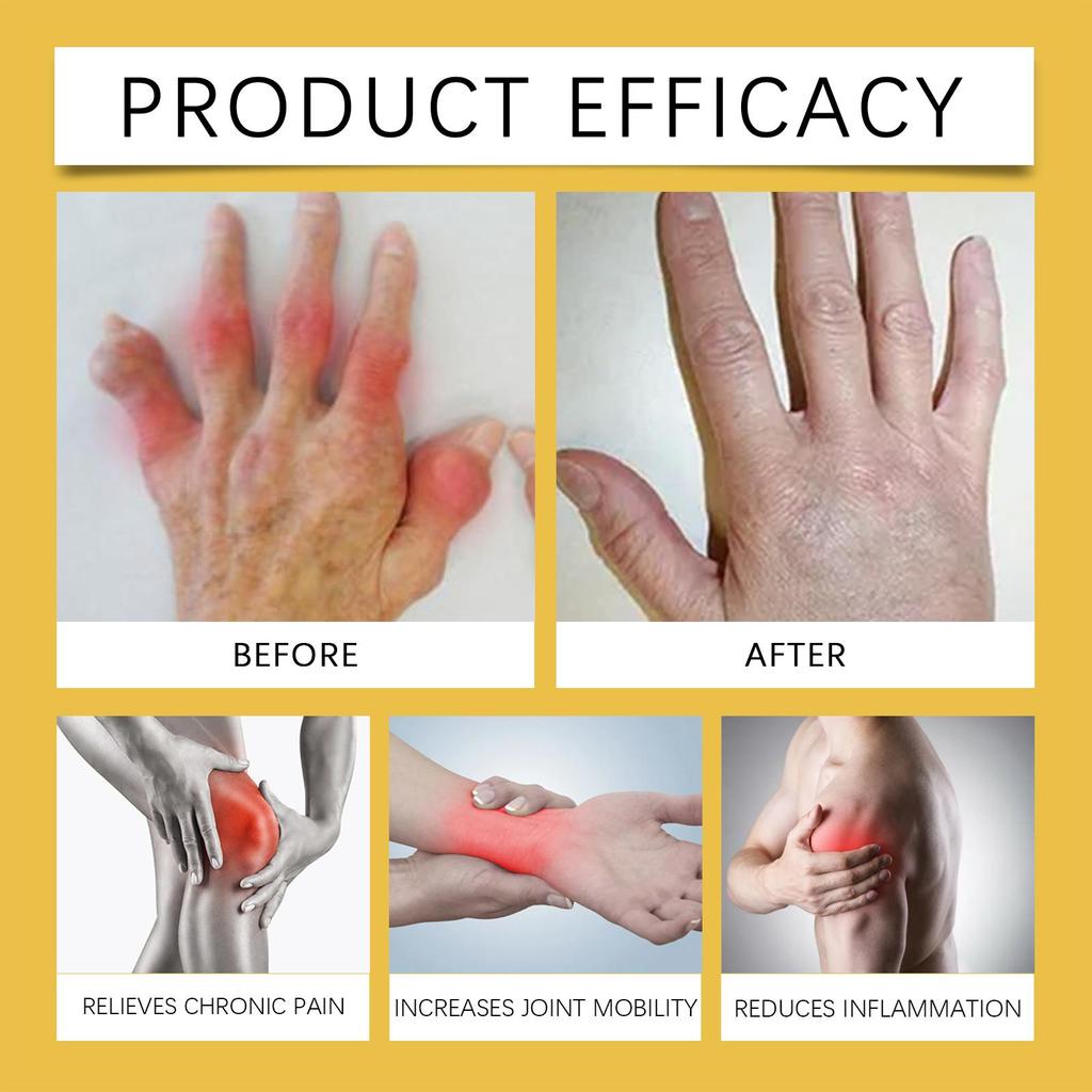 Bee Venom Body Cream Gentle Moisturizing Apply Wrists Knees Body Massage Topical Repair Cream