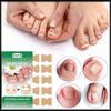 BUPY Nail Fold Care Patch: Repair Thickened Fungal Nails and Correct Ingrown Nails, Hot-Selling Cross-border Solution.