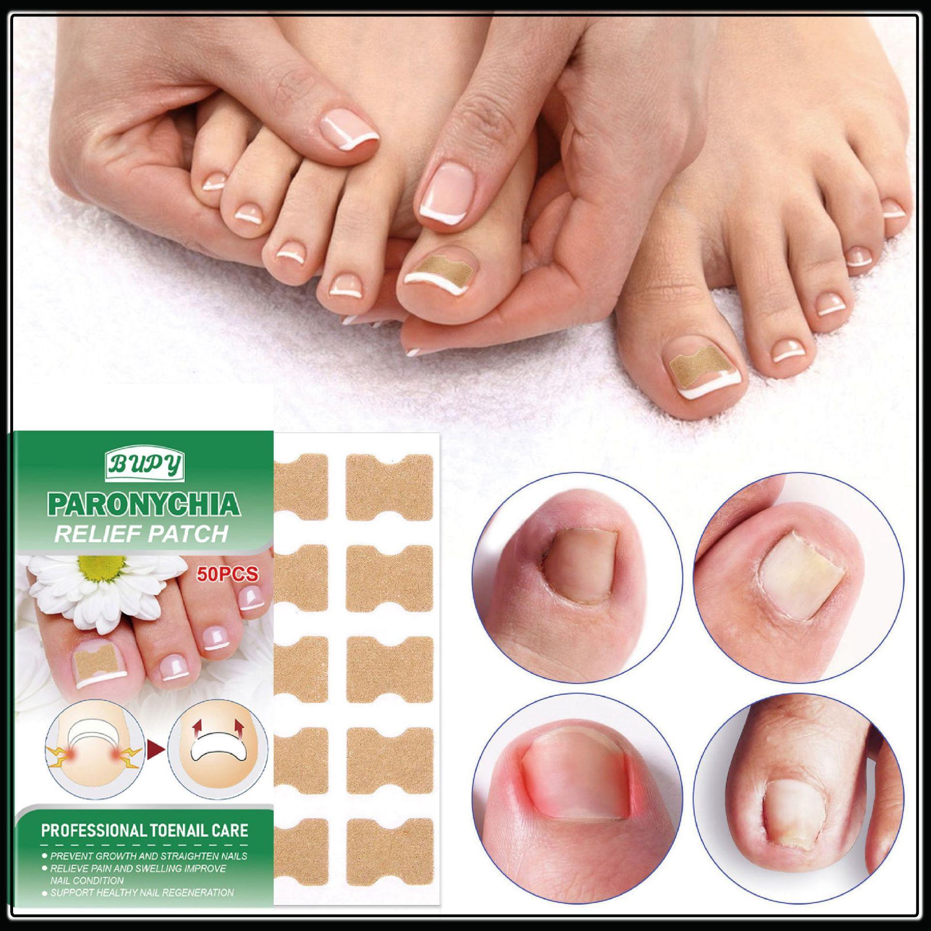 

BUPY Nail Fold Care Patch: Repair Thickened Fungal Nails and Correct Ingrown Nails, Hot-Selling Cross-border Solution. 100