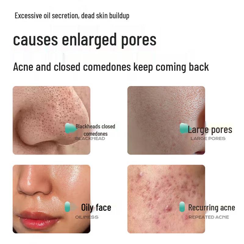 Nanjing Tongrentang Pore Refining & Blackhead Removal Essence