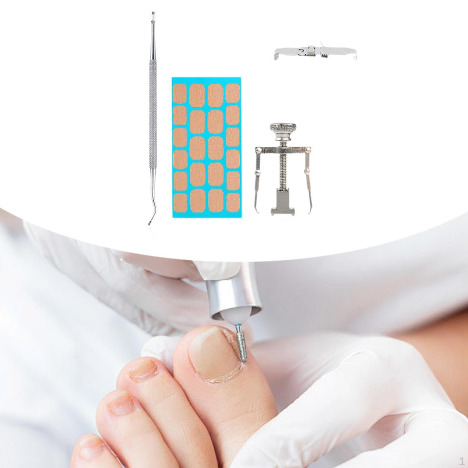 

Ingrown Toenail Tool Set Efficient Toe Nail Correction Buckle Foot Care Size 44