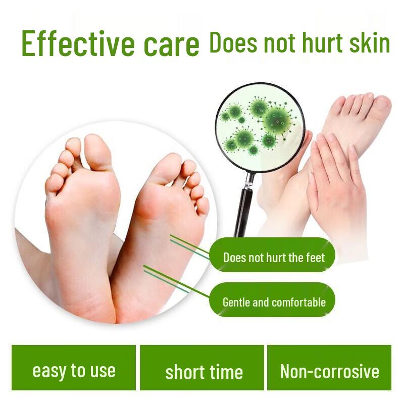 Yushitang Athlete's Foot & Odor Relief Spray