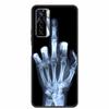 For Tecno Camon 17 Pro Cases 17P 17 Soft TPU Silicone Phone Cover for Tecno Camon 17P Back Cover Bumper Fundas Camon17 CG7n Capa