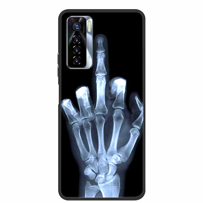 For Tecno Camon 17 Pro Cases 17P 17 Soft TPU Silicone Phone Cover for Tecno Camon 17P Back Cover Bumper Fundas Camon17 CG7n Capa