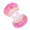 Transparent Adult Teeth Model Pathological Repair Studying Dental Teaching Tools