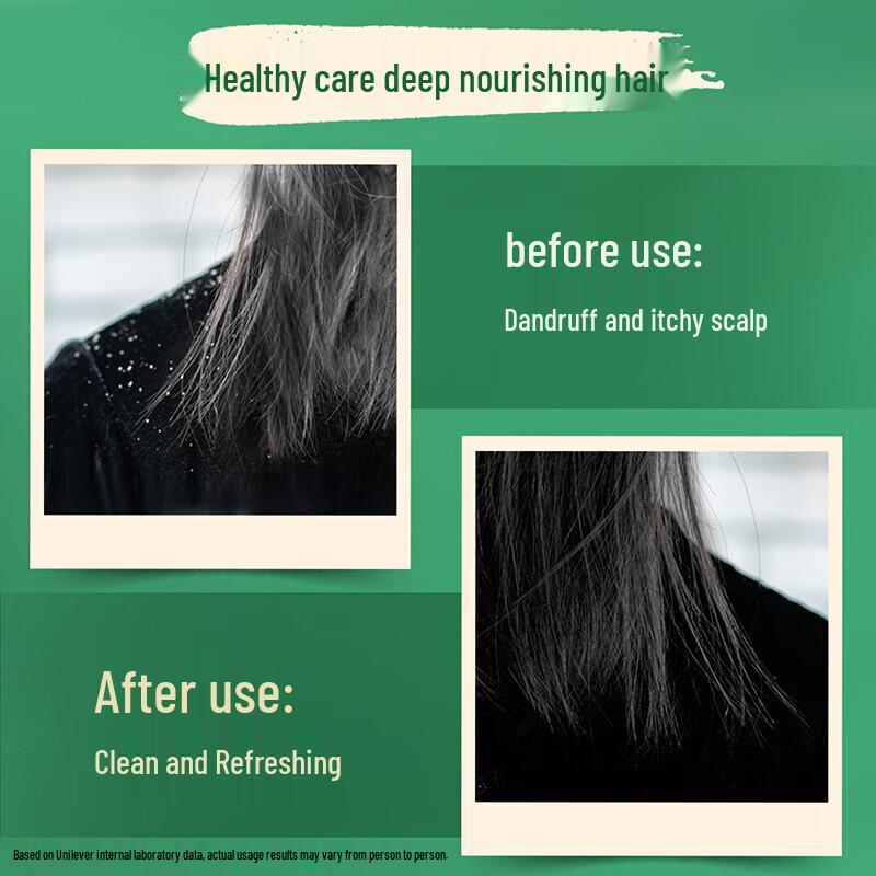 Hazeline Black Sesame & Soapnut Nourishing Anti-Dandruff Shampoo