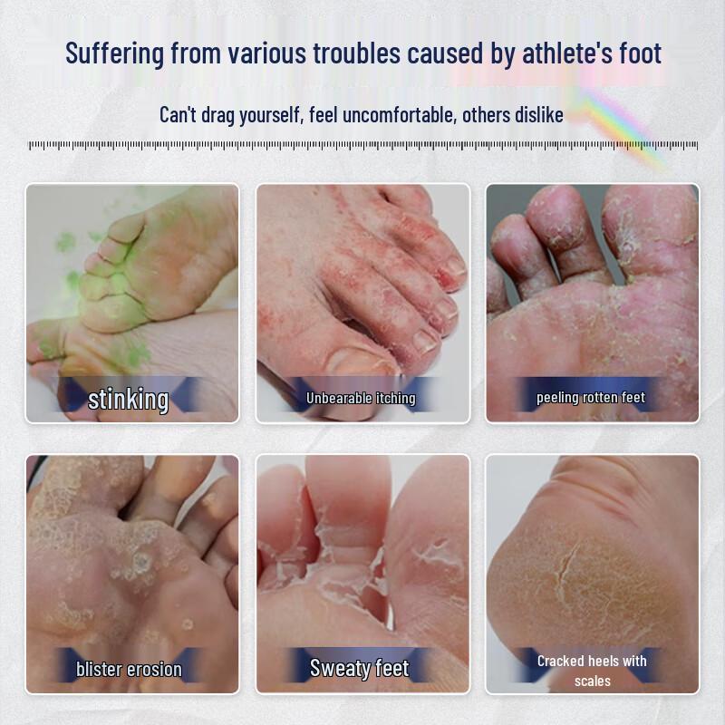 Anti-Fungal Foot Odor Treatment Kit