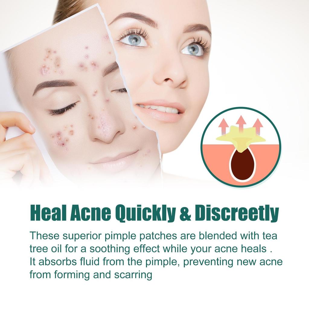 112pcs Acne Pimple Patch / Acne Treatment Stickers / Pimple Remover/Blemish Spot Face Skin Care