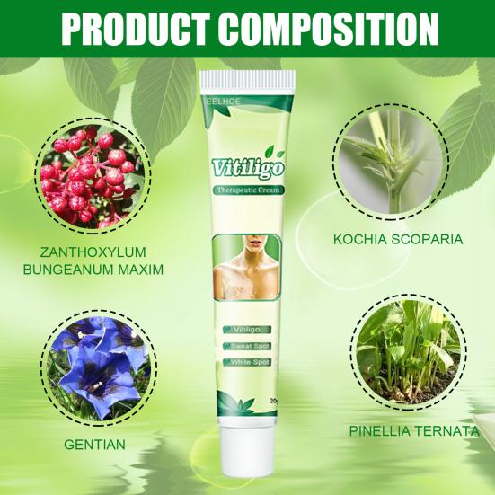 20 g White-Tag-Creme, einzigartige Verwendung von Pflanzenextrakten, therapeutische Vitiligo-Creme