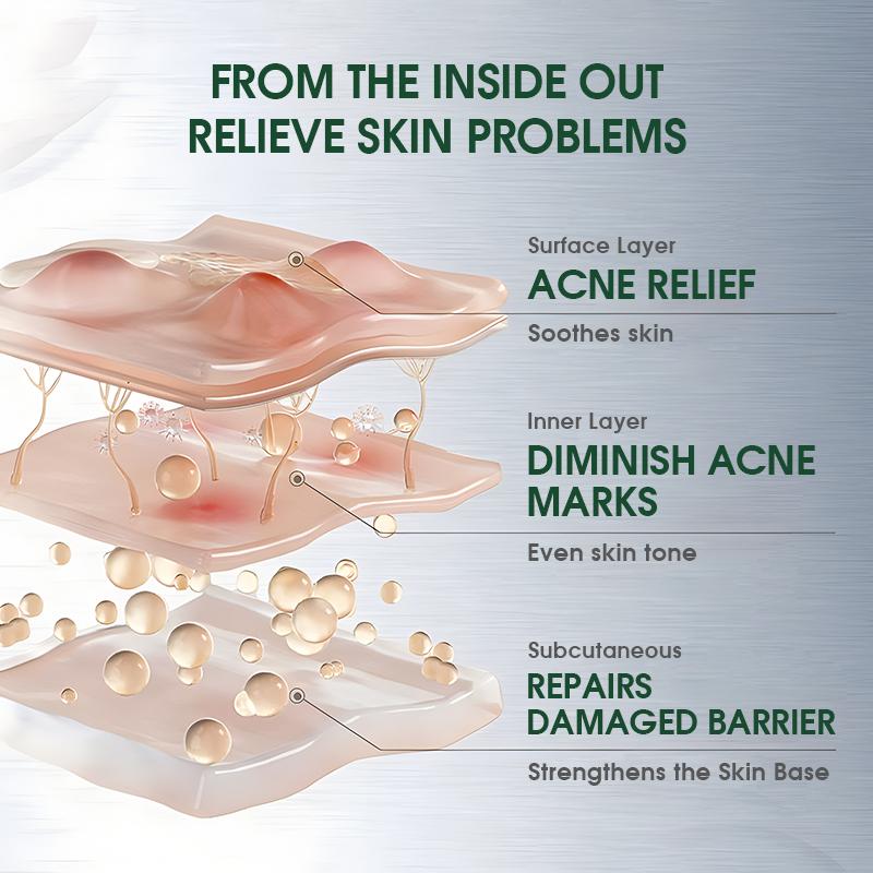 Tea Tree Centella Asiatica Relief Serum Lightweight Vegan Ampoule for Acne-Prone Skin Soothing Calming Oil Balance