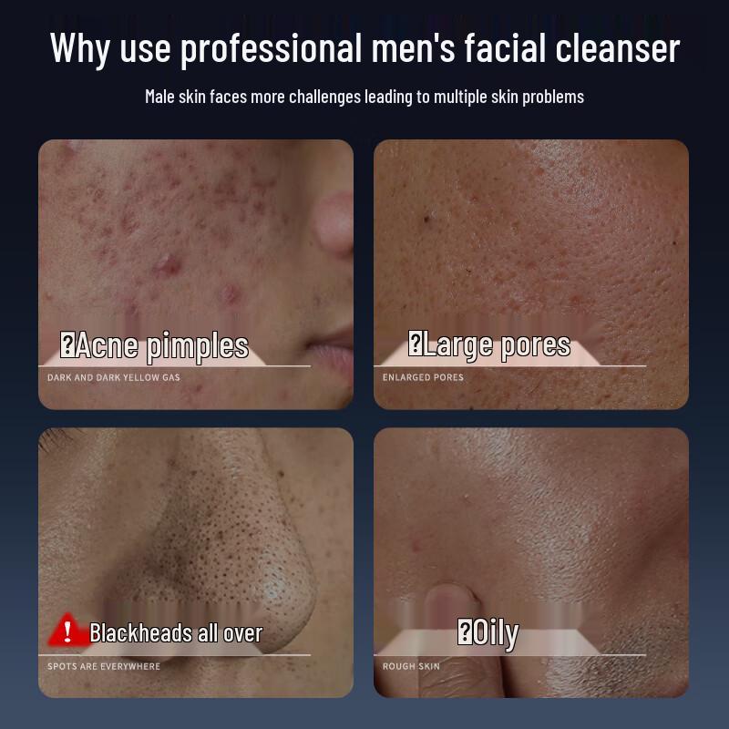 

Qingyan Men s Oil Control Acne Facial Cleanser