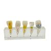 Dental Pulp Restoration Pathological Model Detachable Teeth Dissecting Premolar Teeth Cavity Filling Dentist Material