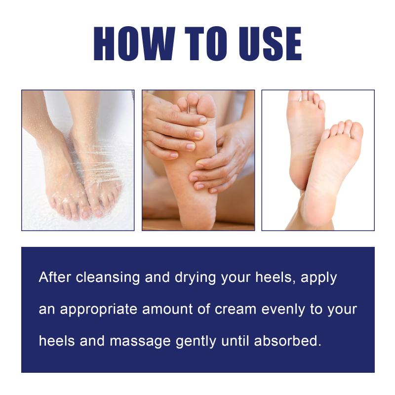 

Foot Dryness And Cracking Care Cream Feet Skincare Moisturizing Hydrating Firming Nourishing Repairing Feet Cream Foot Skin Care one size