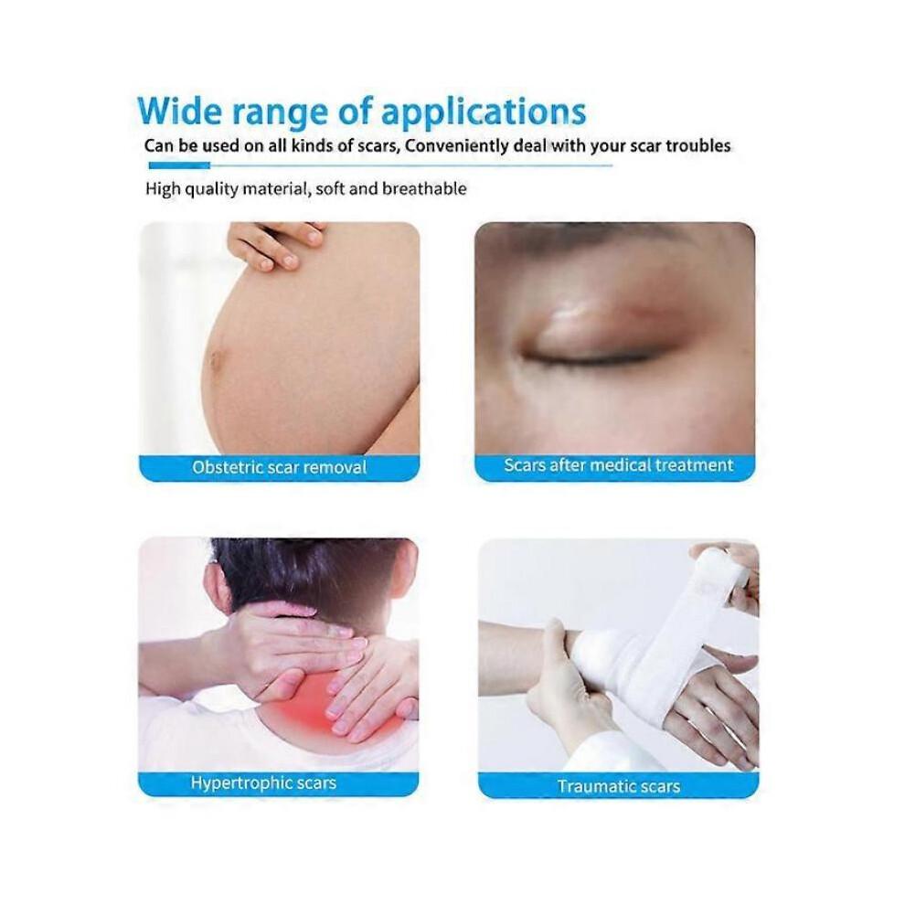 Losveo Silicone Scar Sheets for Face Wrinkles,Medical Grade Silicone Scar Sheet