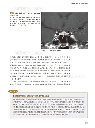 Pituitary gland imaging