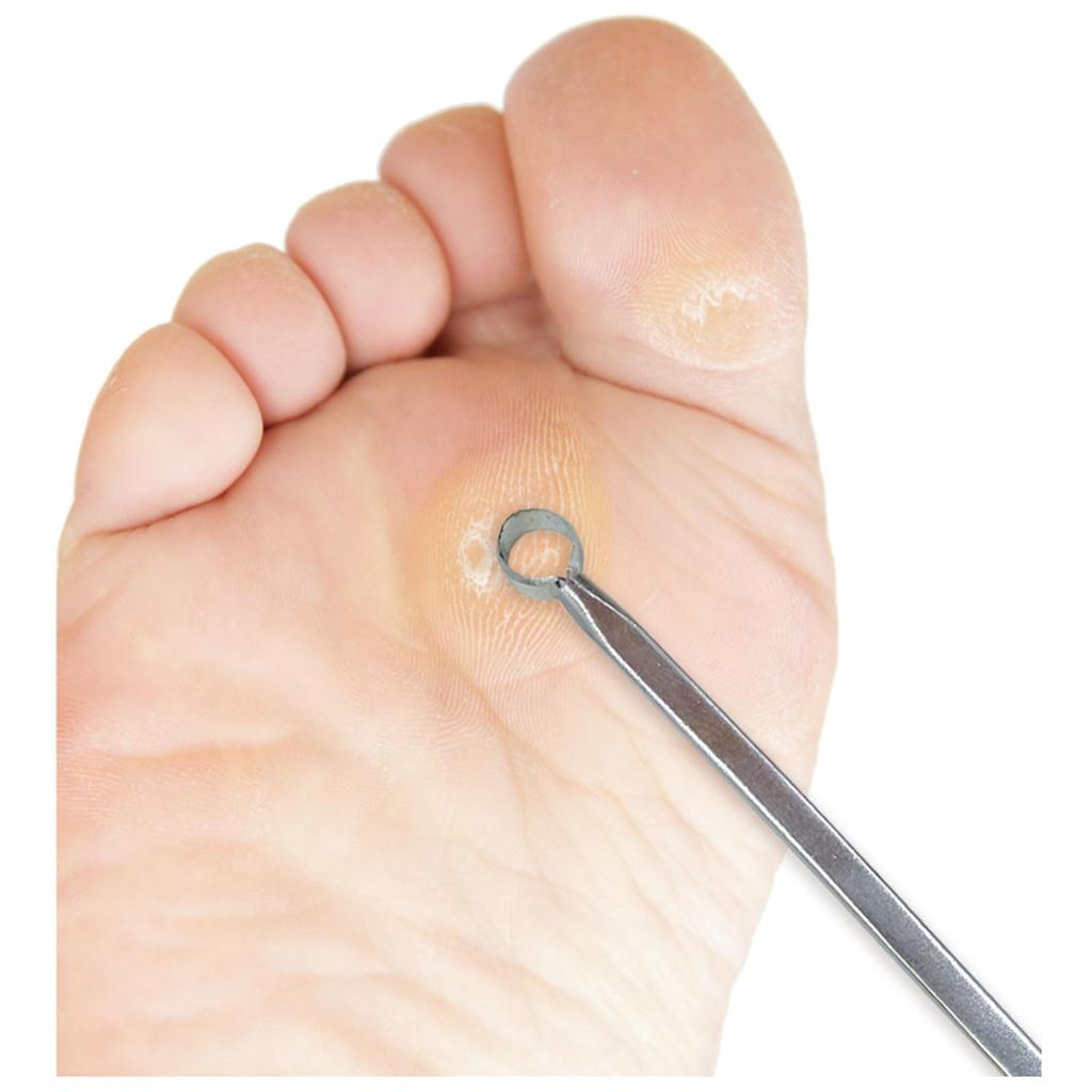 Rooro Pinpoint Callus File RO-PY