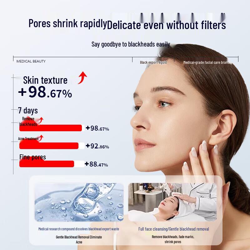 BEAUTY NOTES Blackhead Removal Serum Kit