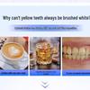 Saky Whitening Enzyme Toothpaste