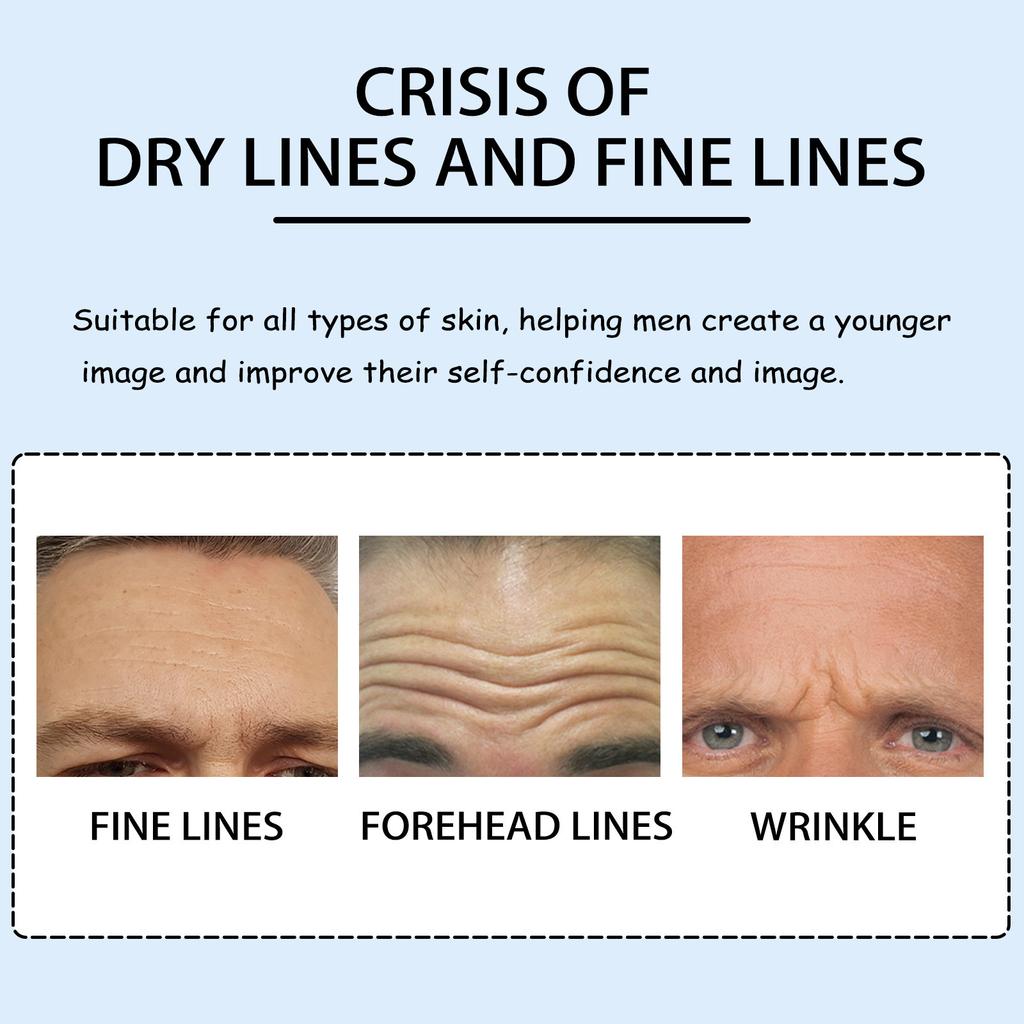 East Moon Men'S Anti-Wrinkle Forehead Sticker, Smoothing And Firming The Forehead, Fading Fine Lines And Wrinkles Character Lines Anti-Wrinkle Sticker