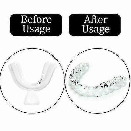 2024 New 12pcs Silicone Mouth Guard for Teeth Grinding, Anti-Clenching Night Guard, Snoring Prevention Sleep Dental Guard
