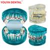 New Dental Orthodontic Treatment Model Standard Teaching Model Dental Teeth Model With Bracket Half Metal Half Ceramic 2 Colors