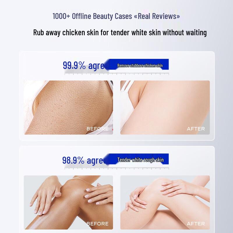 Huameike Compound Acid Exfoliating Cleansing Gel