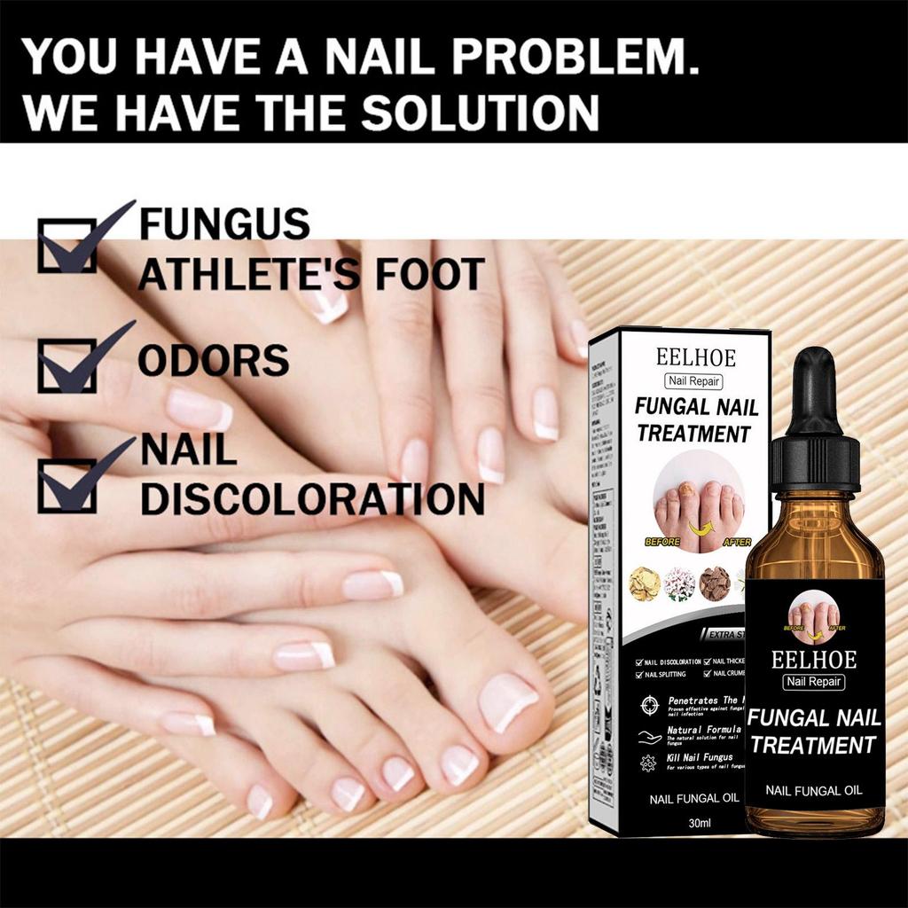 EELHOE Nail Repair Serum Thickens & Brightens Nails Removes Dullness Repairs Nails Moisturizes Beautifies Nails Nourishes & Conditions Nails