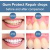 Rapid Repair Gums Serum Effectively Relieve Tooth Allergy Dental Caries Tooth Cleaning Toothpaste Relieve Tooth  Damage Drops