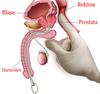 Edelstahl Harnröhrenkugeln Sounding Massagegerät Insert Katheter Penis Plug Harnröhren Dilatator Männlicher Schwuler Stimulator Sexspielzeug für Männer