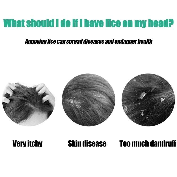 Remove Lice Comb Painless Comfortable Hair Health Black Steel Comb
