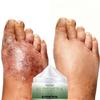 Қолдар мен аяқтарға арналған тері күтімі – Аяққа арналған кремдер мен маскалар