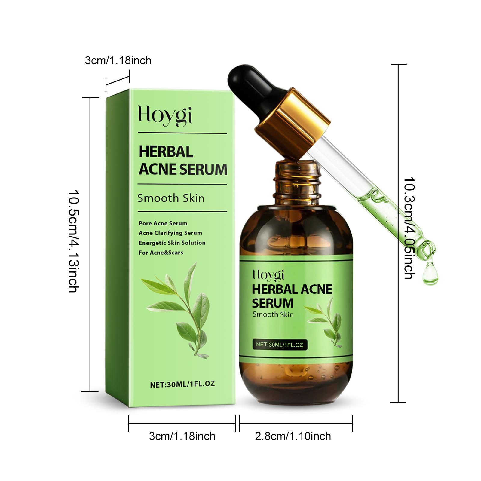 

Hoygi 30ml Herbal acne essence, used to reduce acne, acne and blackheads 30ml